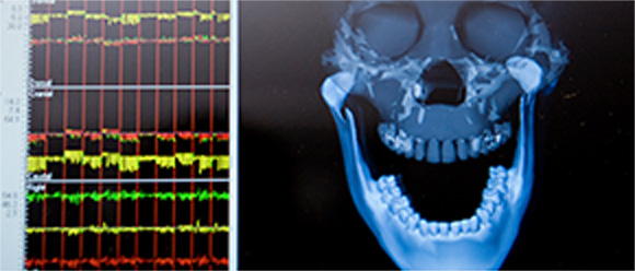 レントゲン検査